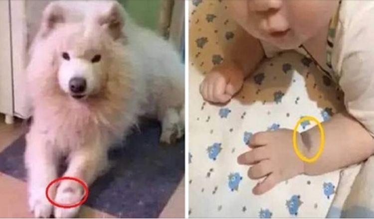 Une femme assure que son bébé est la réincarnation de son chien à cause d’une tache de naissance